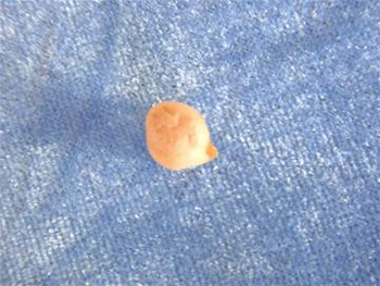 �ൺ�ƹ�ӥ�춹 ������֮����������